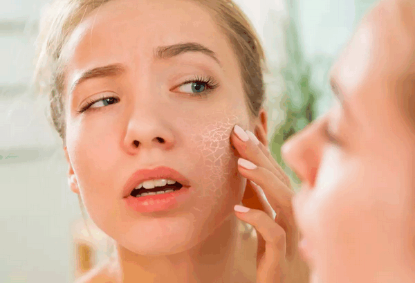 Dry Skin After Laser Hair Removal: Causes and Solution