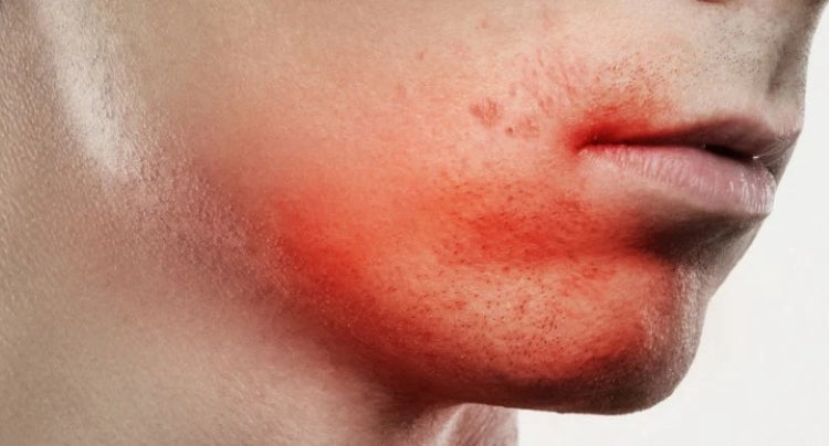 Summer Skincare: Hair Removal & Sun Protection