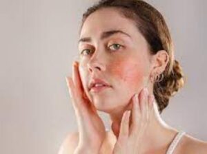 Exploring the Benefits of Peptide in Post-Laser Hair Removal Recovery