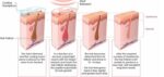 Is Laser Hair Removal Worth It? (& Why)