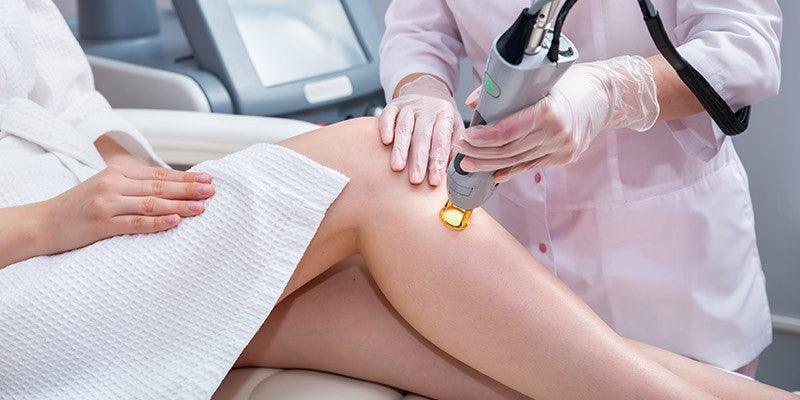 IPL vs. Alexandrite Laser Hair Removal