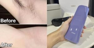 The 6 Best Ways to Removal Hair on Buttocks at Home