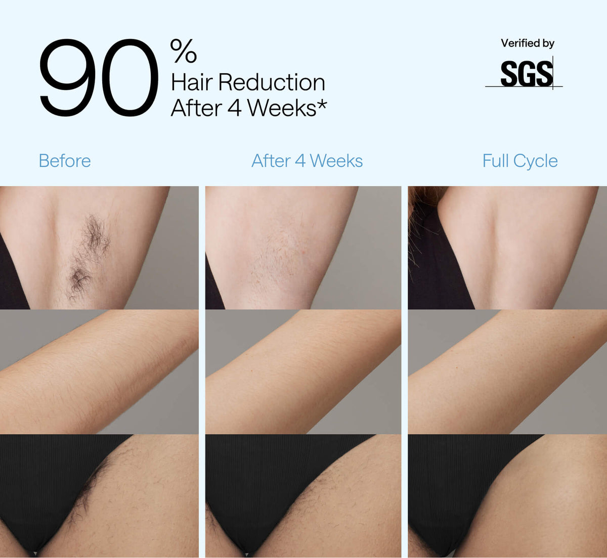 Ulike Air 2 IPL Hair Removal Device & UV Sterilization Box Set