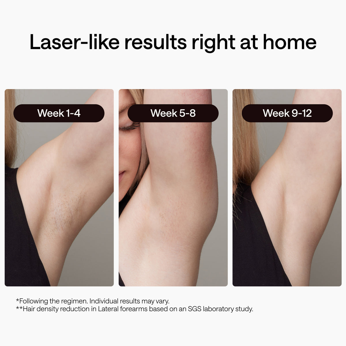 Ulike Air 2 IPL Hair Removal Device & UV Sterilization Box Set