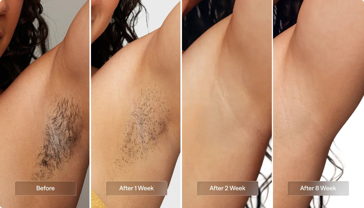 Armpits