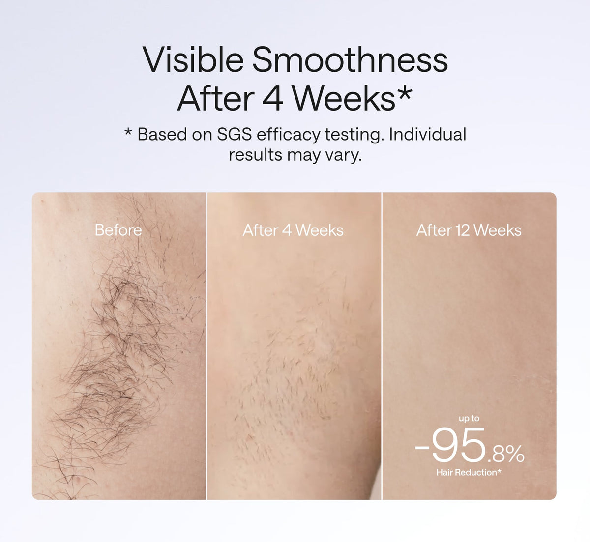 Ulike_Air_4_visible_smoothness